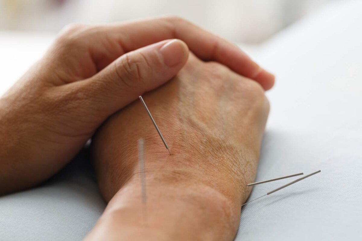 wrist hand pain acupuncture dry needling therapy_11zon